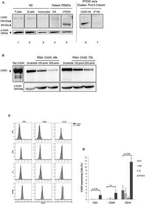 CASK, the Soluble Glomerular Permeability Factor, Is Secreted by Macrophages in Patients With Recurrent Focal and Segmental Glomerulo—Sclerosis